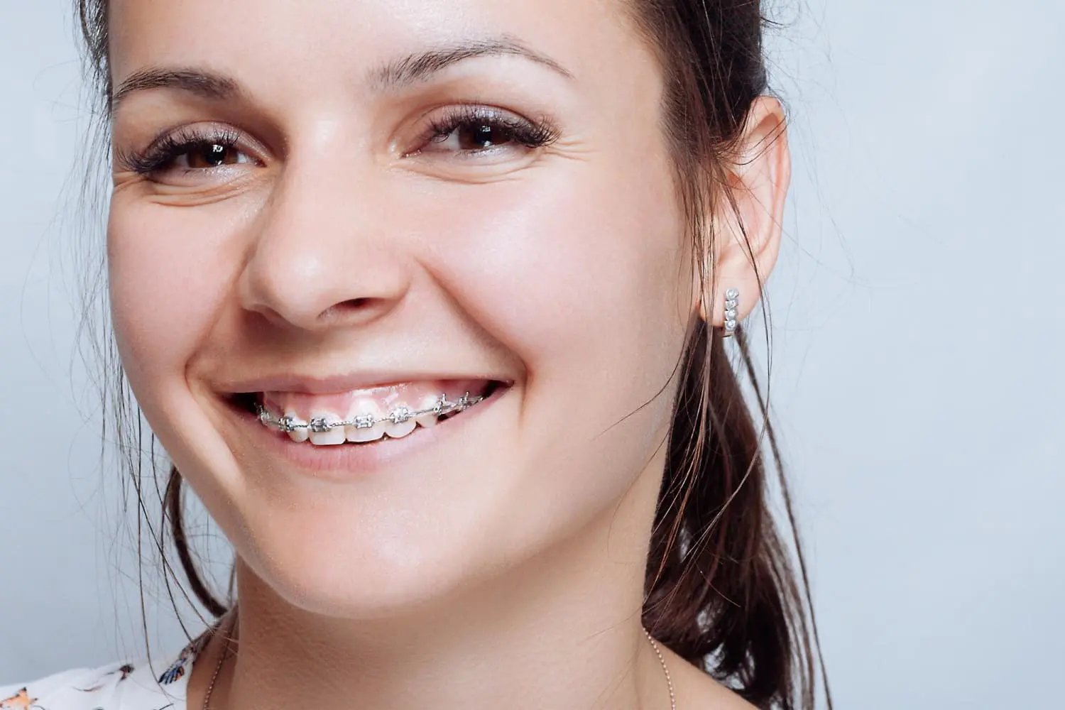 Smiling woman with brown hair and braces, representing adult orthodontics at Lenius Orthodontics in Overland Park, KS.