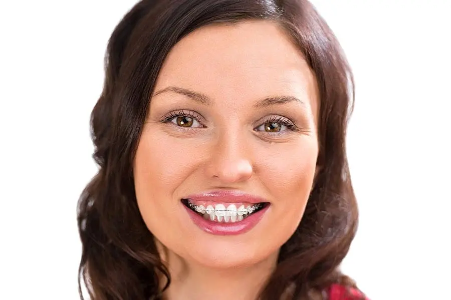 Smiling woman with long brown hair and clear braces, pictured on a white background at Lenius Orthodontics in Overland Park, KS.