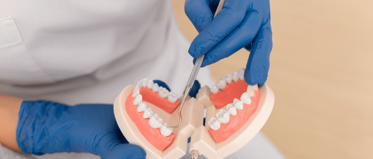 A person in blue gloves demonstrates Clear Braces on a teeth model at Lenius Orthodontics in Overland Park, KS.