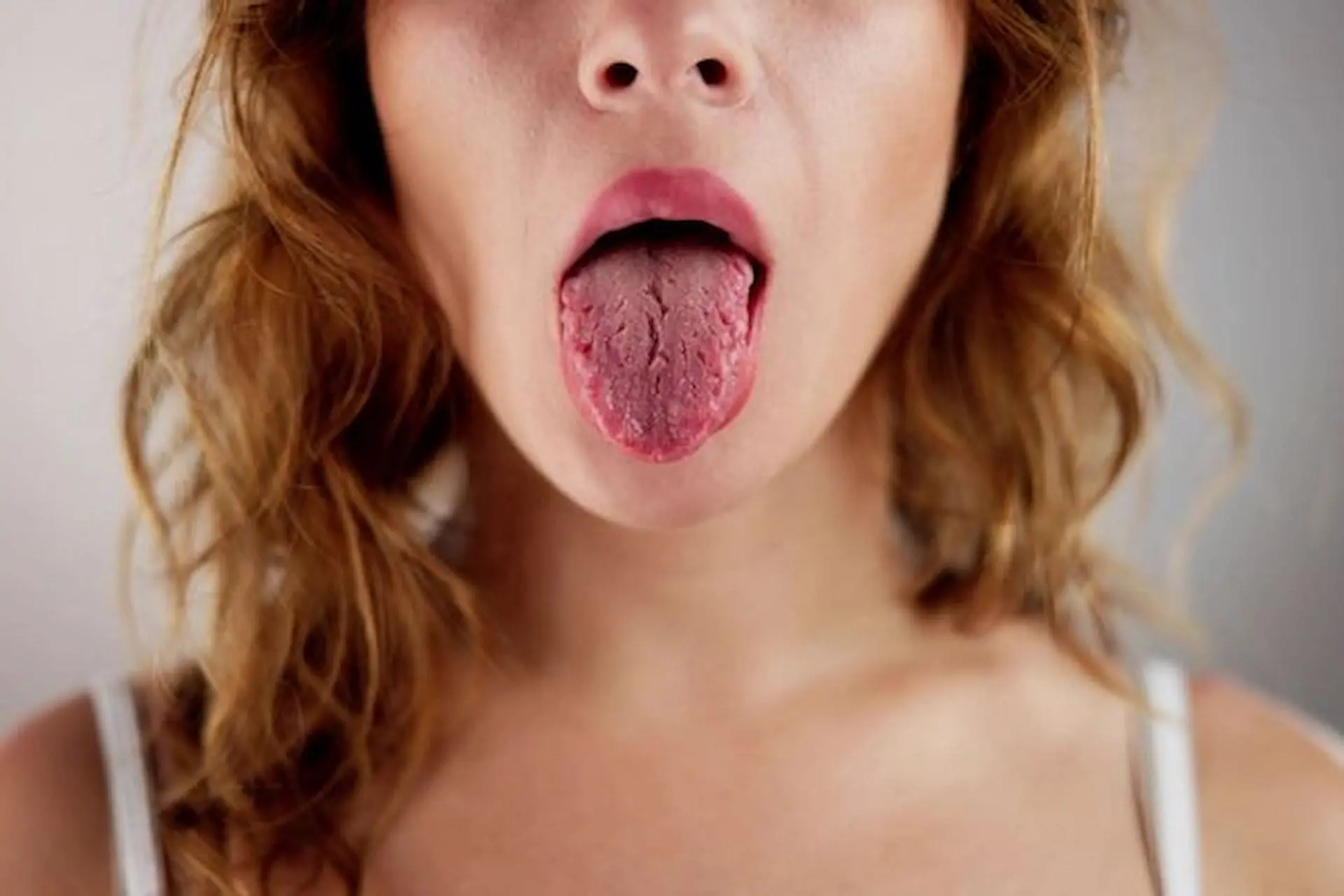 A woman with wavy hair show relationship between mouth breathing and dry mouth for Lenius Orthodontics in Overland Park, KS.