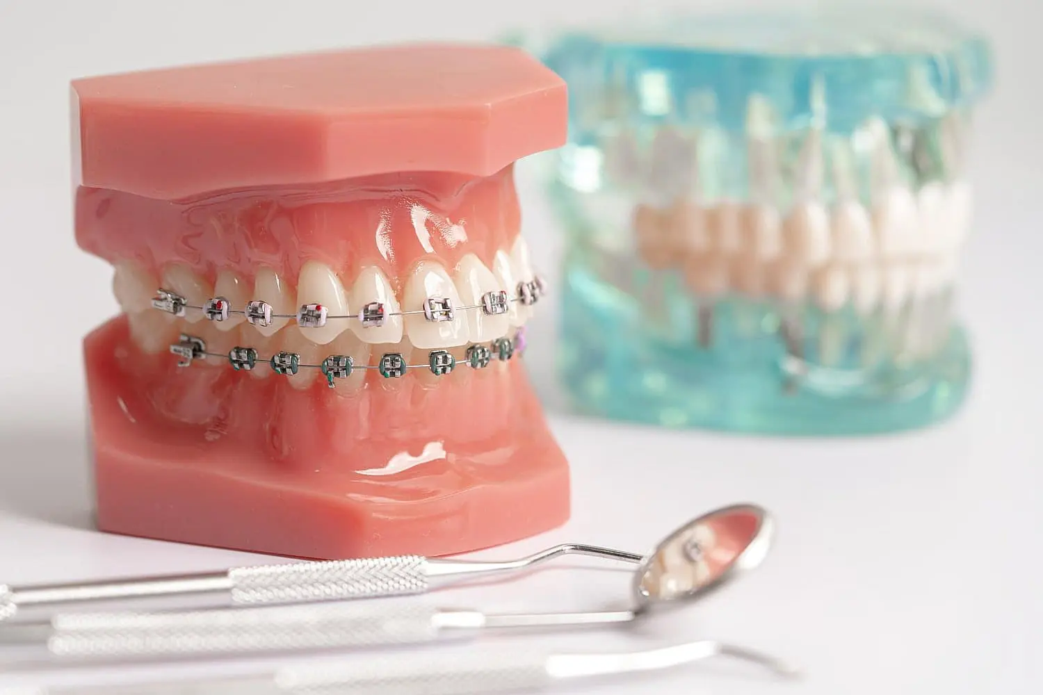 Dental models with and without metal braces are shown with dental tools at Lenius Orthodontics in Overland Park, KS.