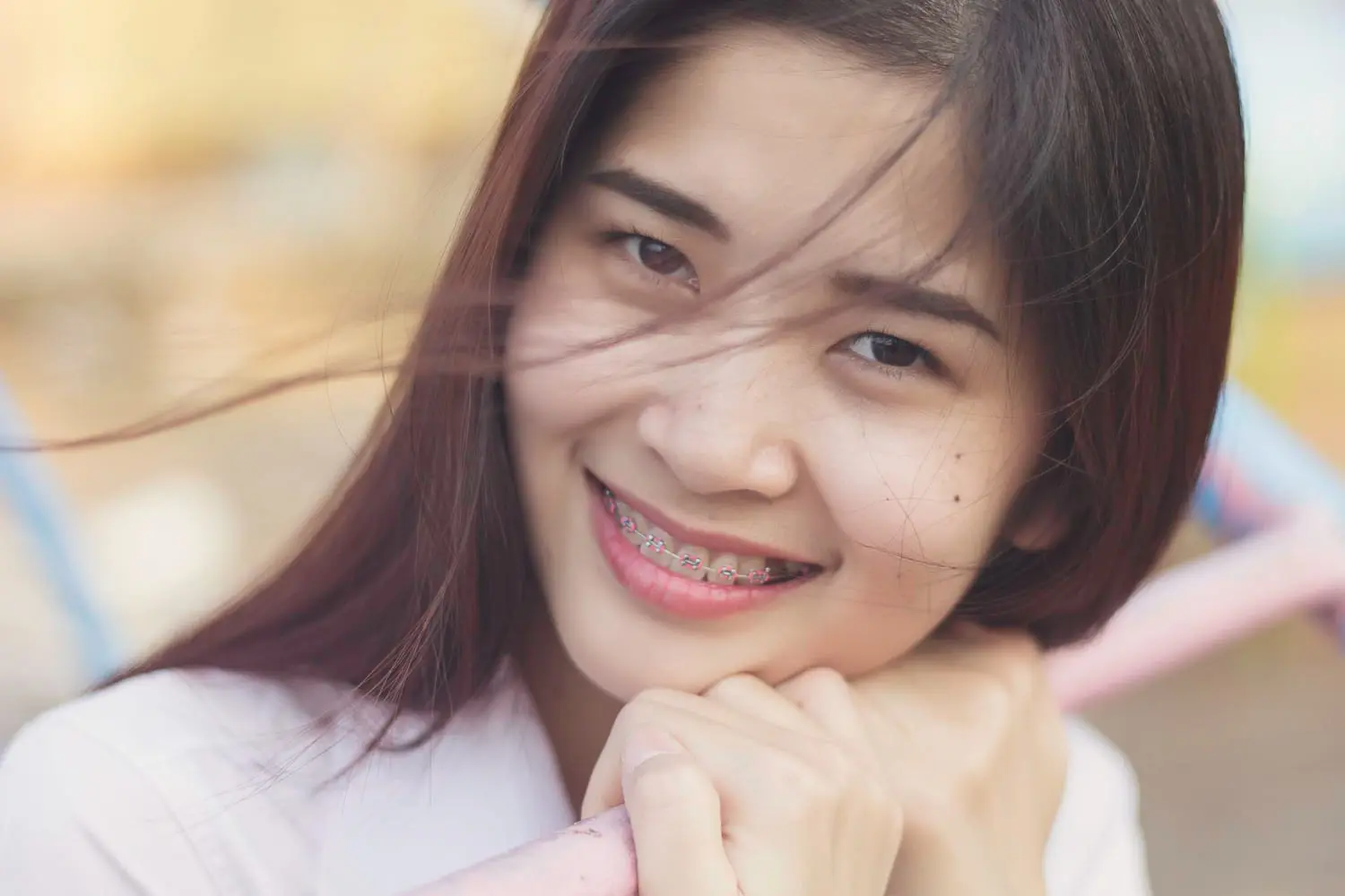 Smiling outdoors, a young woman with metal braces from Lenius Orthodontics in Overland Park, KS rests her chin on her hands.