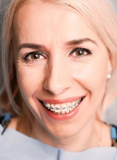 A smiling woman with light hair and metal braces for fix overbite, wearing a light blue top at Lenius Orthodontics in Overland Park, KS.