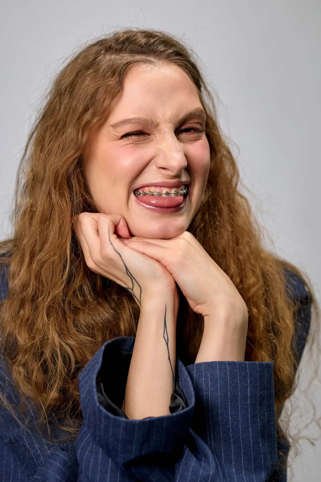 Smiling with braces fix Overbite from Lenius Orthodontics in Overland Park, KS, a person with long curly hair winks and rests their chin on their hands.
