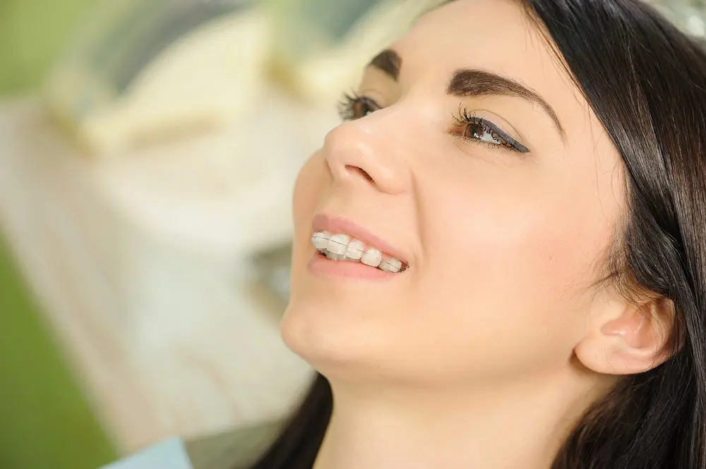 Young woman reclining in a dental chair with clear aligners – Braces for Overbite in Overland Park, KS.