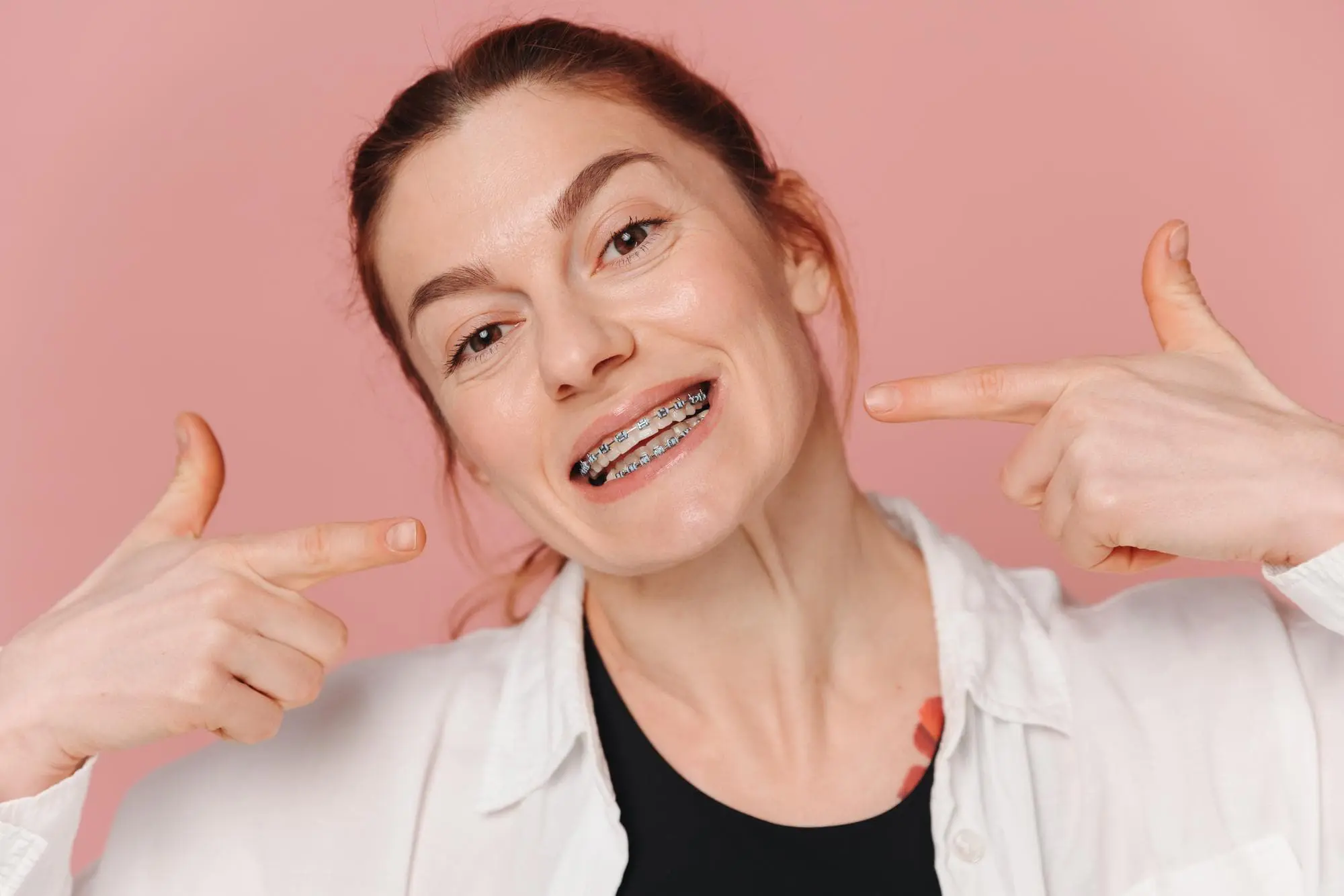 Smiling woman with metal braces points to her mouth; Lenius Orthodontics in Overland Park, KS, pink background.