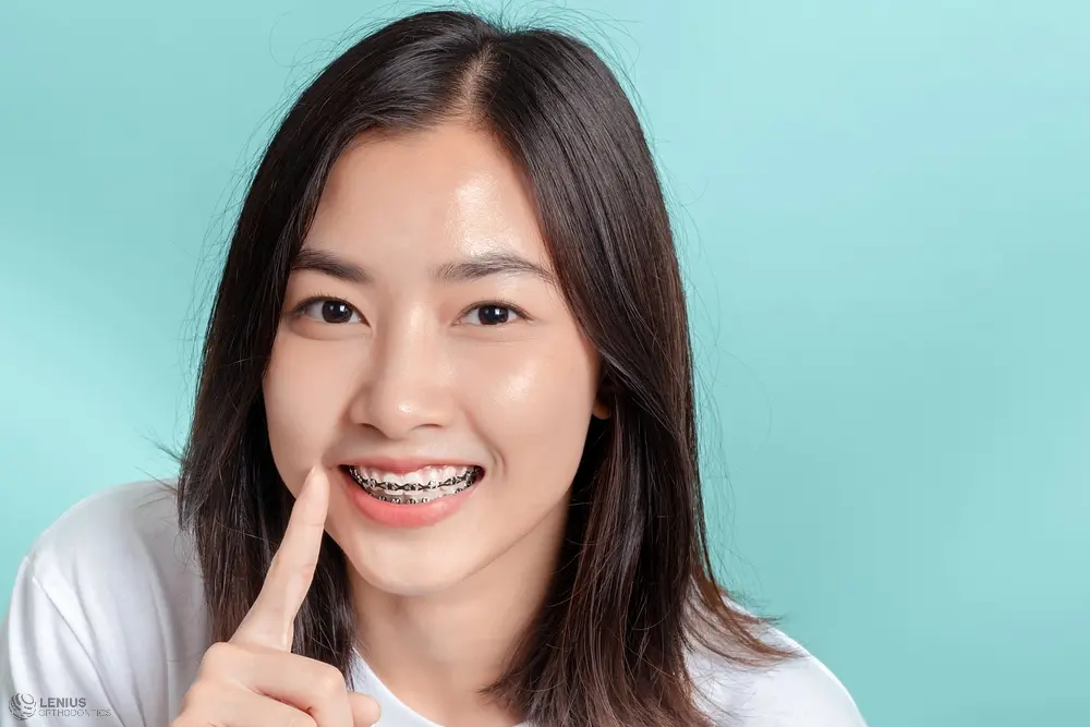 dental braces young asian woman wearing metal braces beauty smile - How To Get Braces Glue Off Teeth in Overland Park, KS 