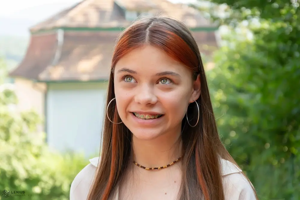 beautiful teenage girl metal braces smiles street - Aligners vs Braces in Overland Park, KS 